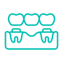 Dental Bridges