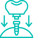 dental-implant